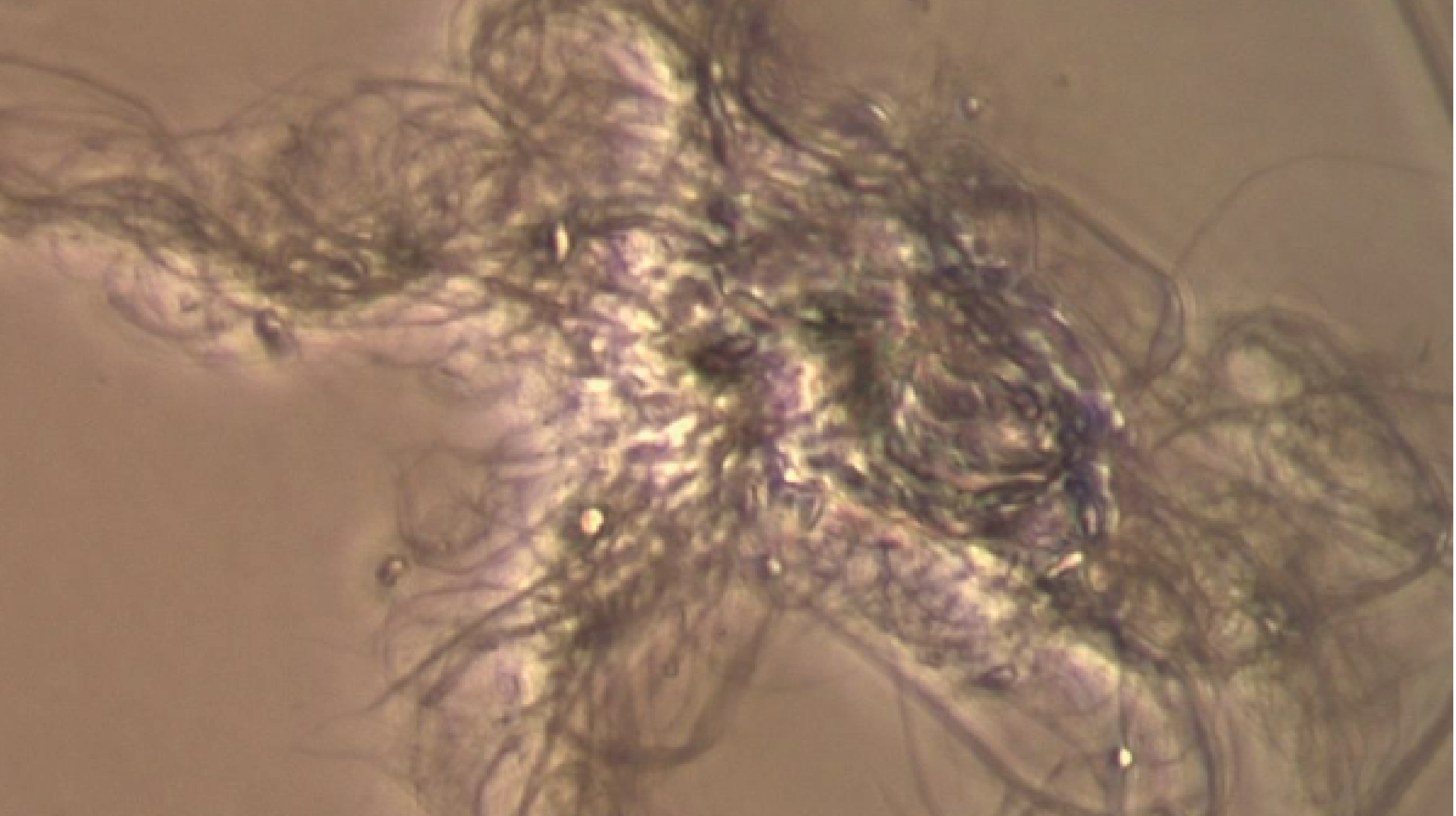 Mikroskopische Aufnahme der Nanozellulose